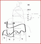 Aquarius - The MEVc Course